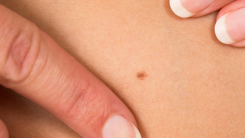 痒い 湿疹 胸の谷間 胸のかゆみの原因と対策
